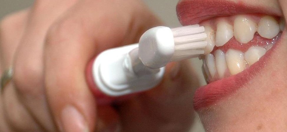 Diş eti kanaması daha büyük bir sağlık sorununun erken habercisi olabilir